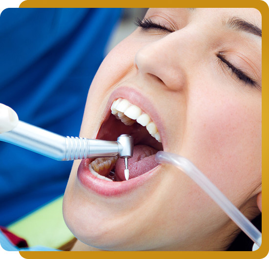 woman getting teeth cleaned with dental tool