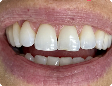 image-4