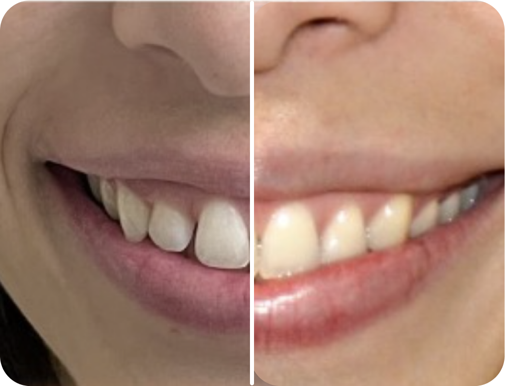 Group 1261155563 3.png