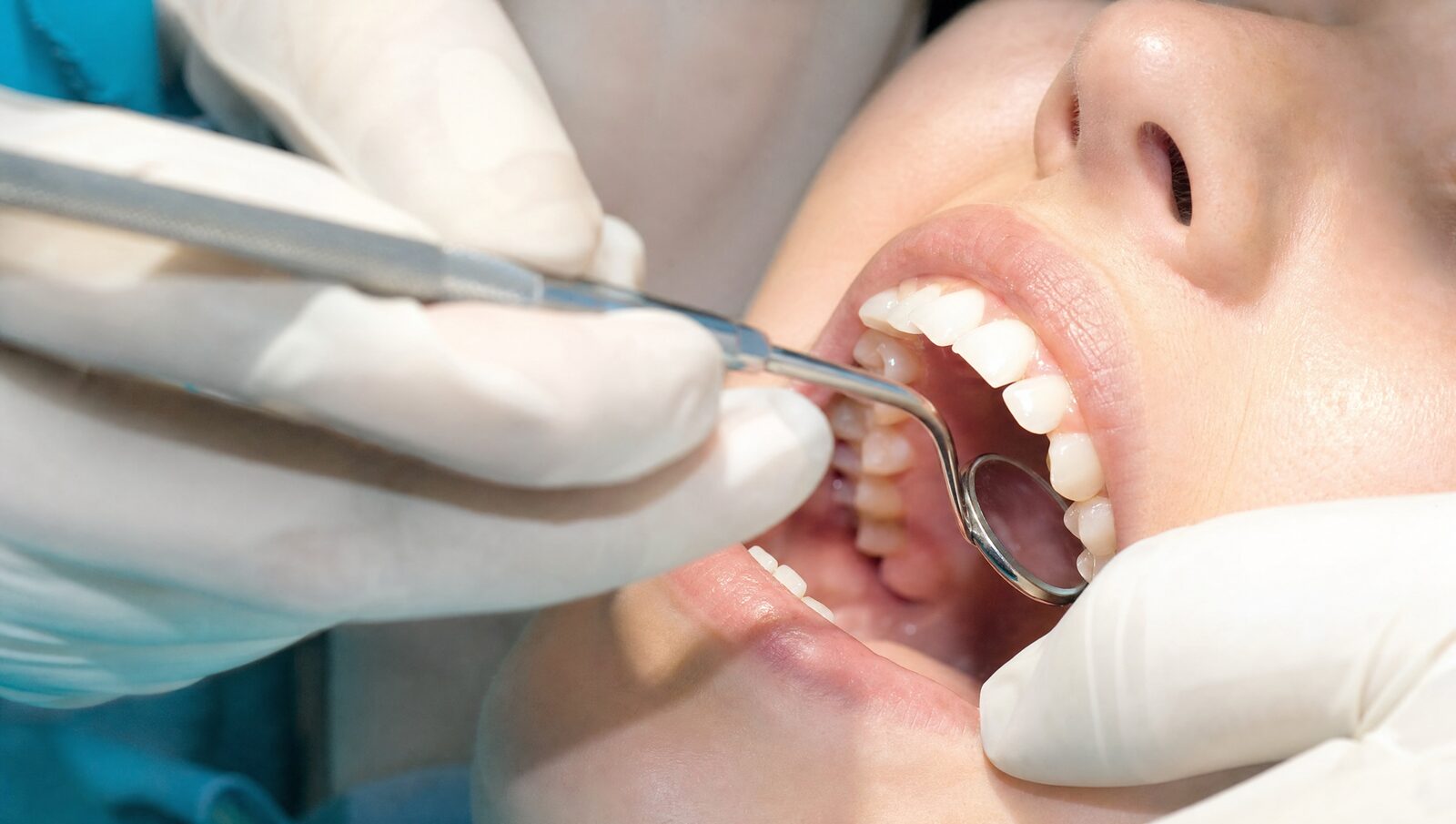 Dentist examining a patient's gum line before gum contouring